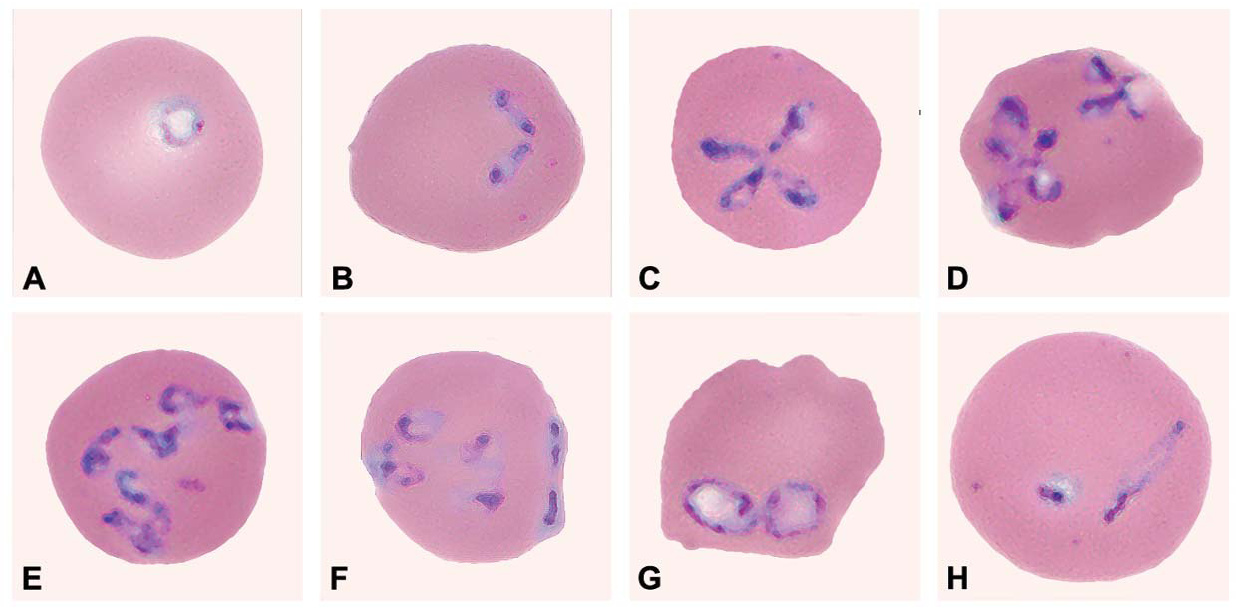 Klíště.cz – Alarming news about babesiosis